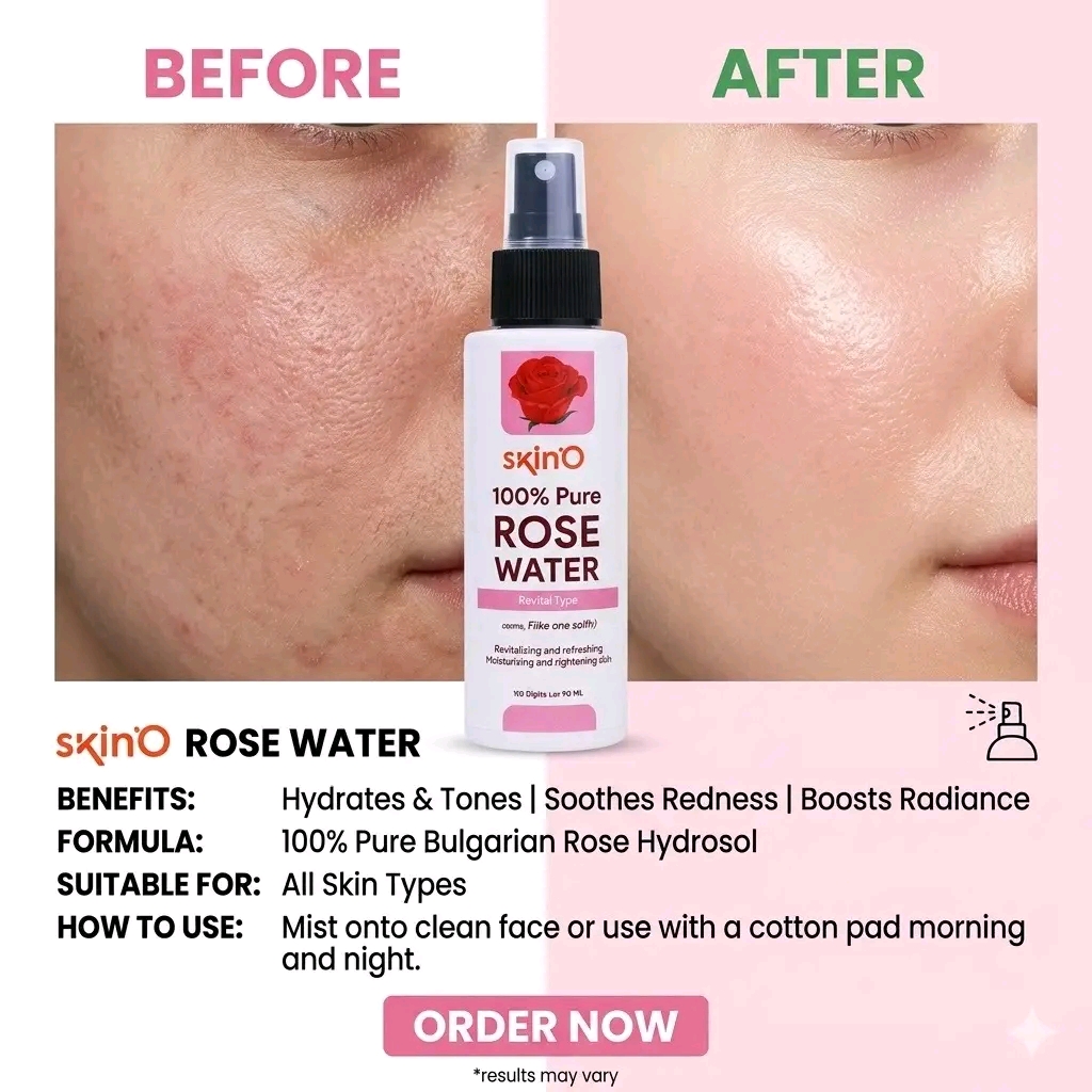 💥🌹𝐒𝐊𝐈𝐍𝐎 𝟏𝟎𝟎% 𝐏𝐮𝐫𝐞 𝐑𝐨𝐬𝐞 𝐖𝐚𝐭𝐞𝐫 (𝟏𝟎𝟎𝐦𝐥)🌹💥