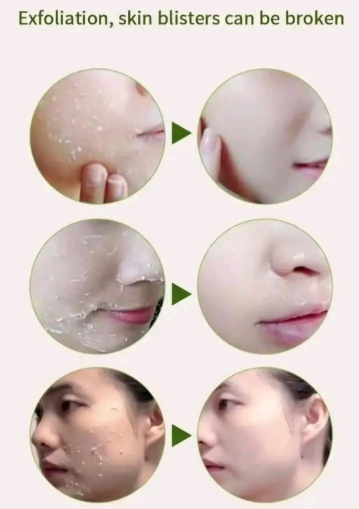 ✨ Pomegranate Peeling Gel ❤️ (ডালিমের পিলিং জেল) Weight : 250g